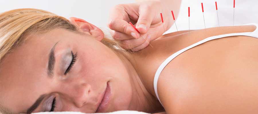 Acupuncture Treatment Specialist Near Me in Elmhurst, IL 