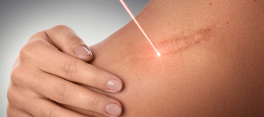 Laser and Light Therapy Clinic Near Me in Elmhurst IL