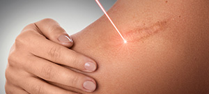 Laser and Light Therapy Clinic Near Me in Elmhurst IL